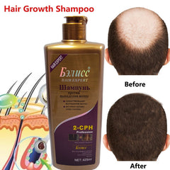 Hair regrowth Fast Shampoo